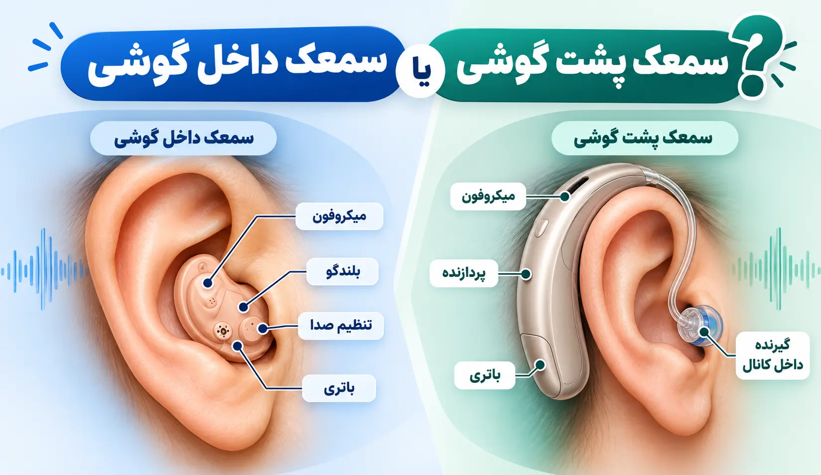 سمعک پشت گوشی بهتر است یا داخل گوشی؟ مقایسه کامل سمعک ها
