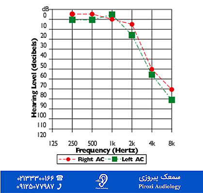 پیروگوشی و تجویز سمعک