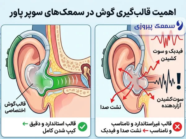 بهترین سمعک برای کم شنوایی شدید