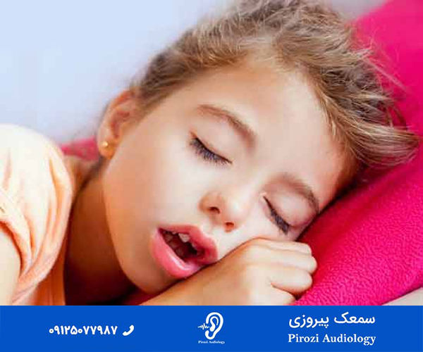 چگونه لوزه سوم را تشخیص دهیم؟